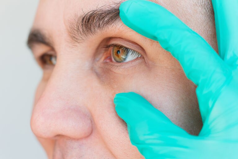 imagen de paciente de oculoplastia de la clinica medel eye hub